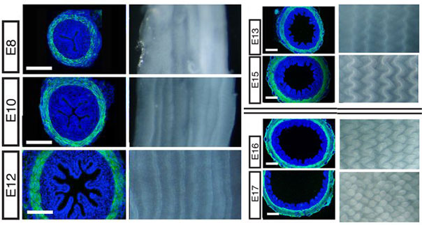 The development of villi. Photo courtesy of L. Mahadevan and Science/AAAS.