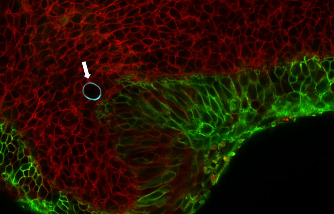 Tissue exerting force on a droplet