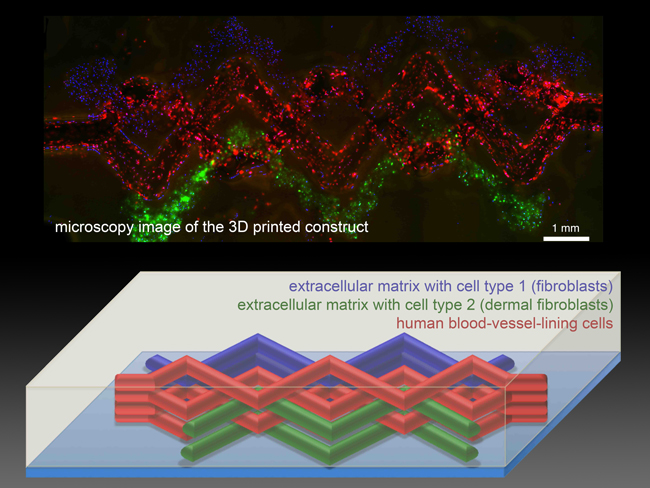 Bioprinting