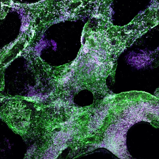 Image of human neural progenitor cells differentiating on the hydrogel scaffold