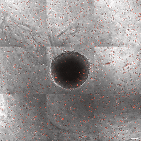 Macrophages (red) inside a tumor spheroid 