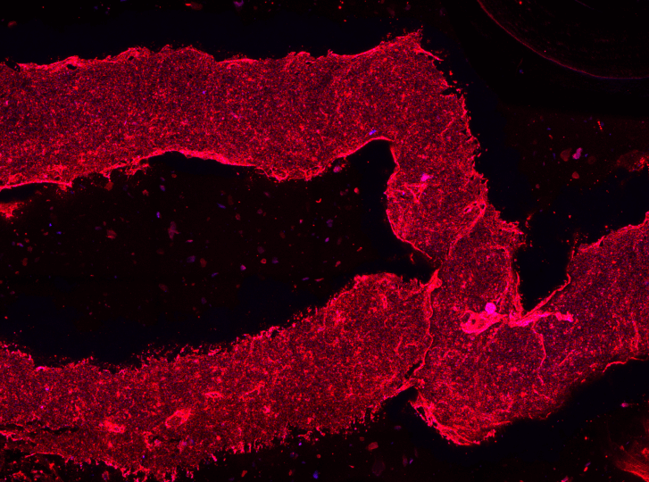 3D-printed blood vessels