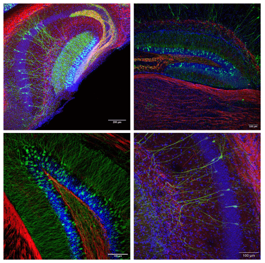 images of mouse brain sections